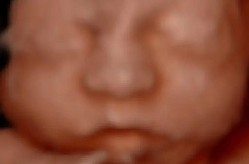 Your Guide to 3D Ultrasound and 4D Services in Brandon, FL